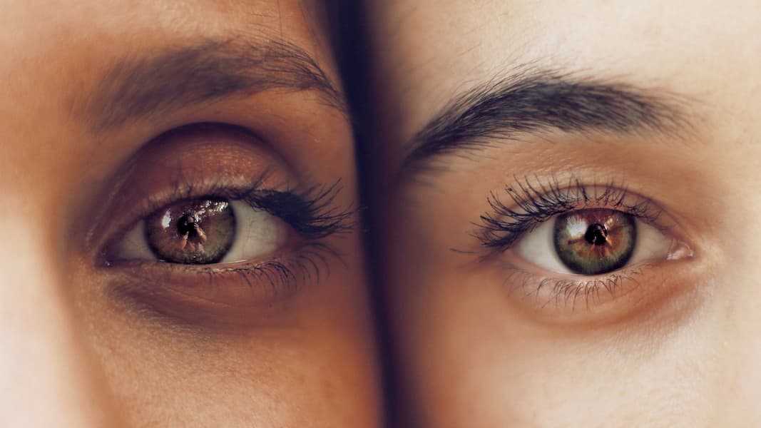 Como quitar una verruga en el borde del ojo