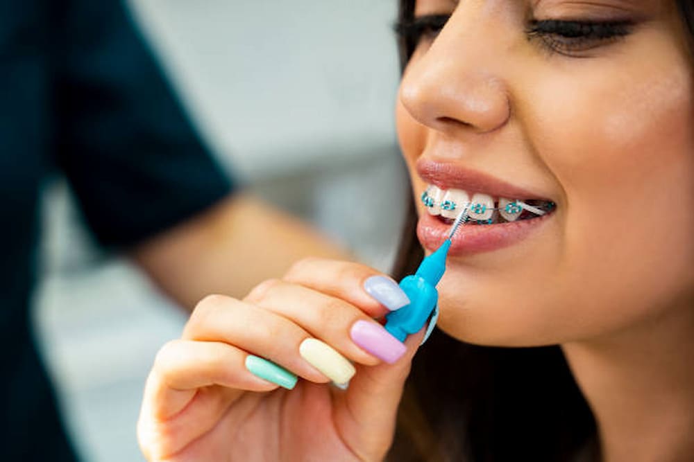 Como usar cepillo interdental